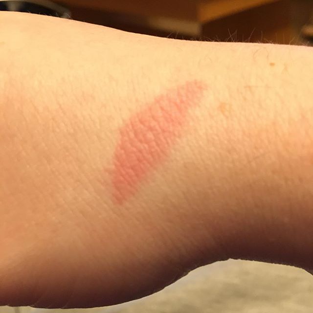Außerdem am Ofen verbrannt ich Depp 🙄 - via Instagram